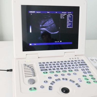 품질  GYN Factory Supply Dw580 Portable Ultrasound Machine For Sale 공장
